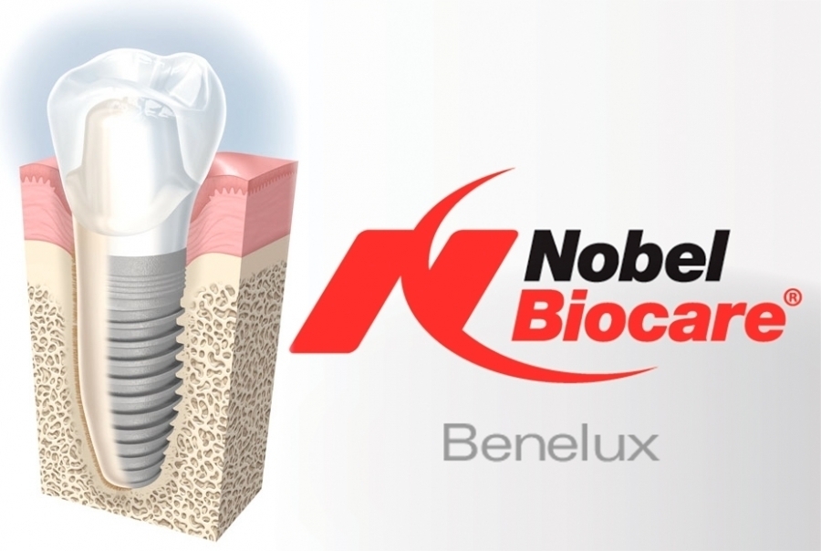 nobel_biocare1.jpg